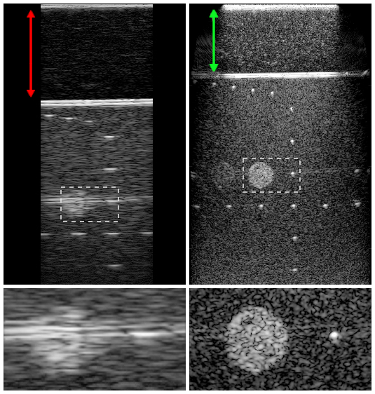 Application of an undulatory method of reflection seismics to the biomedical field