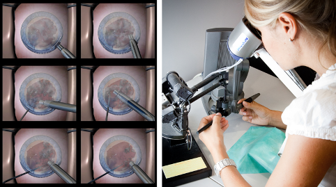 Real-time physical and visual simulations for eye surgery