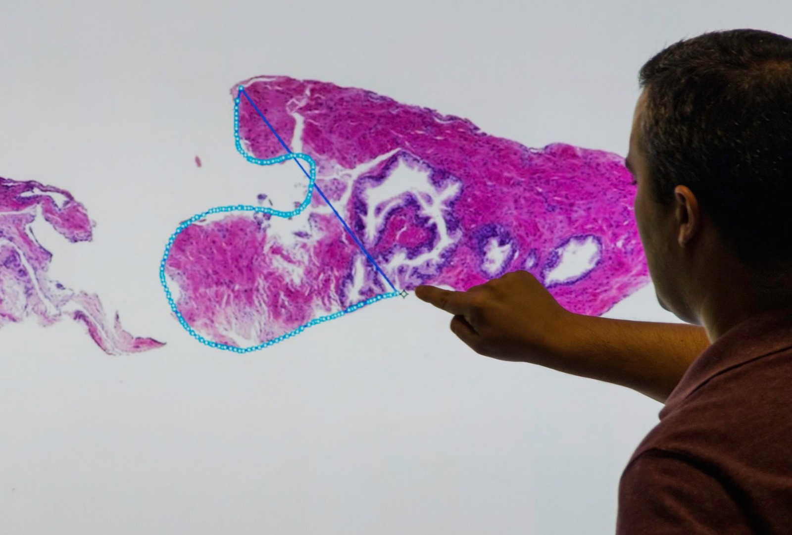 CRS4 Digital Pathology