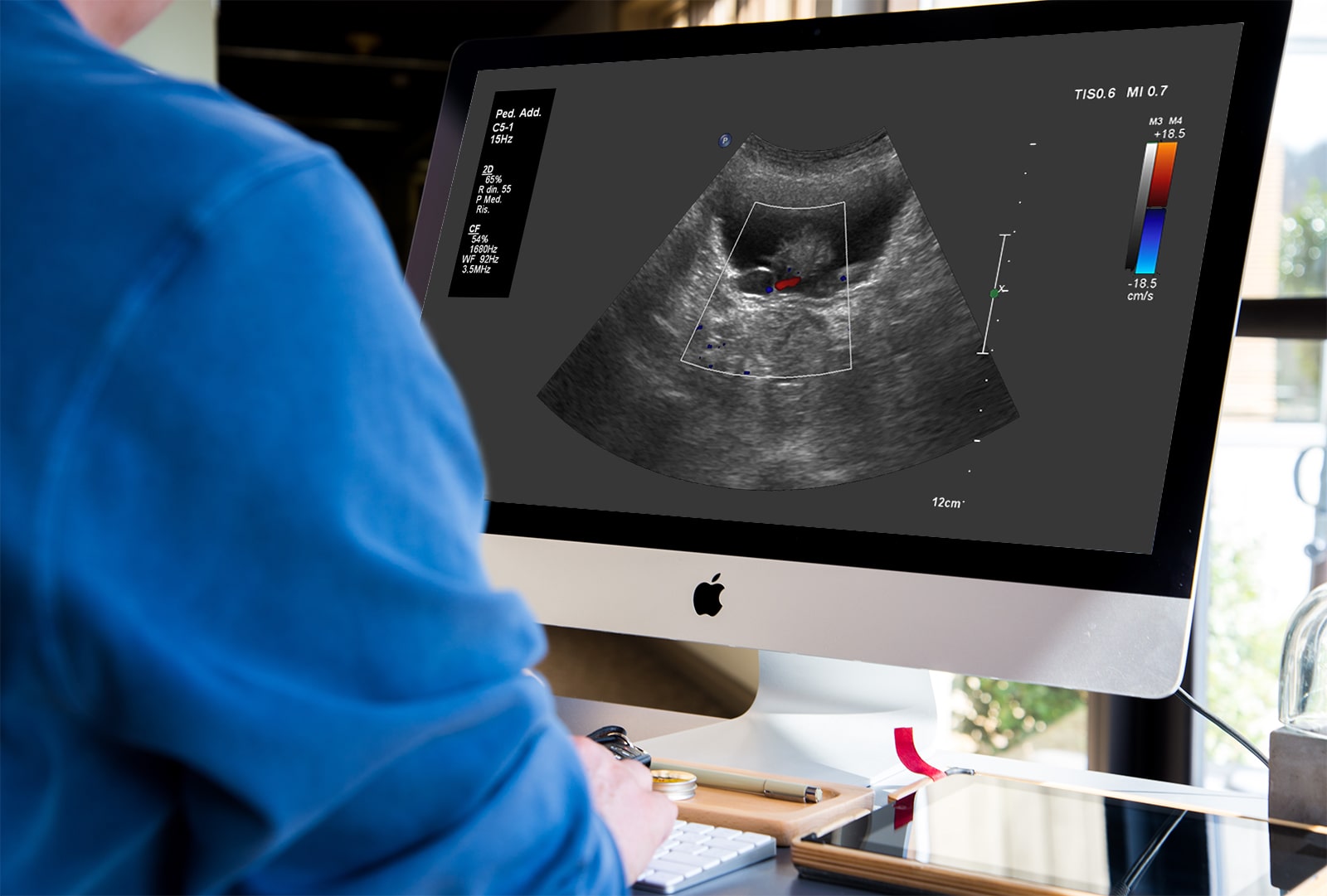 Medico che controlla un'ecografia addominale (immagine a solo scopo illustrativo)